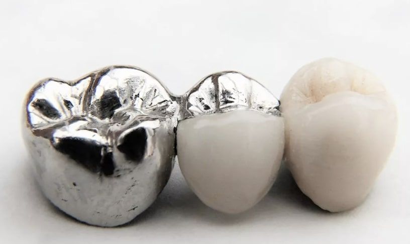 Металлоакриловые коронки