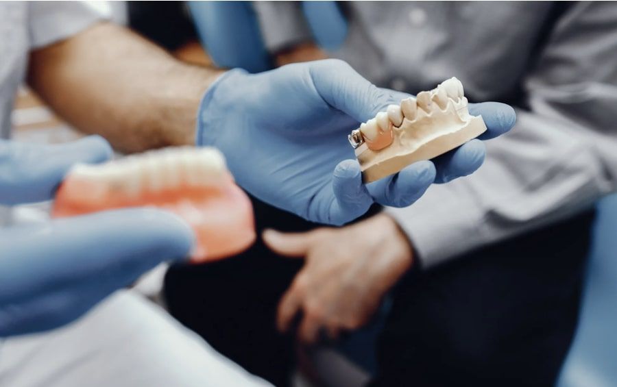 Металлоакриловые коронки