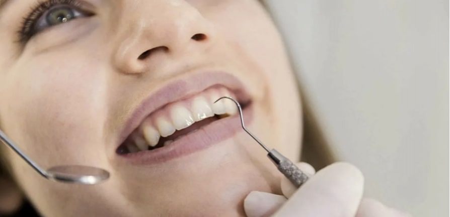 Пародонтологическая чистка зубов