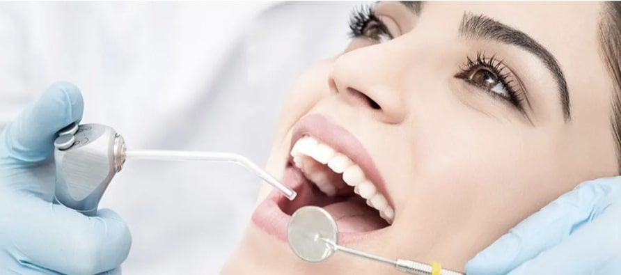 Профессиональная чистка зубов