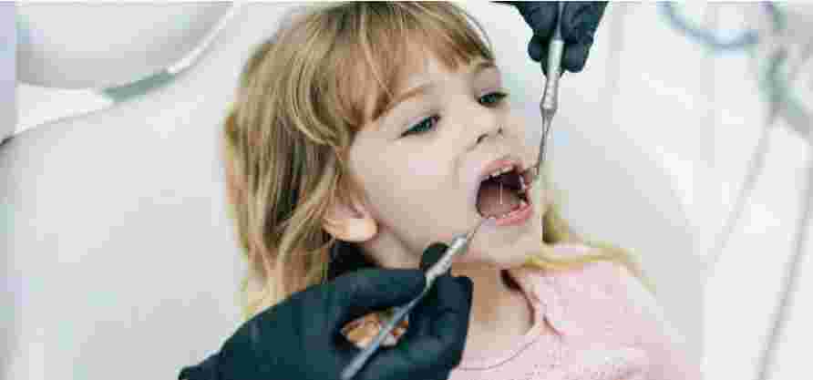 Серебрение молочных зубов у детей